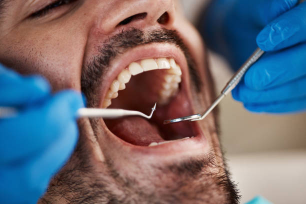 Best Emergency Dentist for Knocked-Out Tooth in Mount Sterling, IL