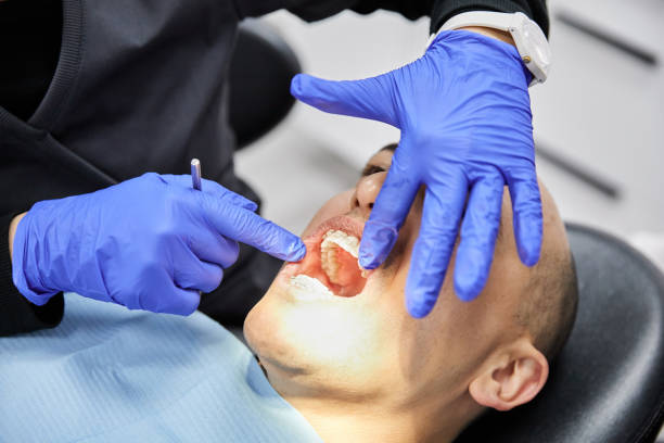 Best Broken or Cracked Tooth Emergency Dentist in Mount Sterling, IL
